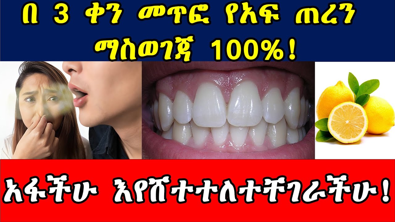 🔴 በቤት ውስጥ መጥፎ የአፍ ጠረን ማስወገጃ 100% | Bad breath, Halitosis | የአፍ ጠረን ለማጥፋት | Dr. Seife | ዶ/ር ሰይፈ 2024