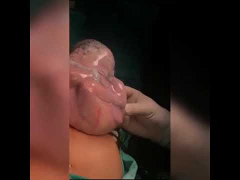 جنين مولود داخل كيس سبحان الله