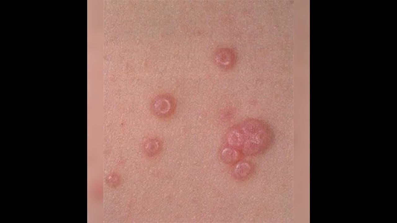 Клиторальды зергерлік бұйымдардың фотосуреттері