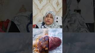 "kutki" The Ultimate 🛡️ for Your Liver✨🍀: #liverhealth #youtubeshorts #shorts #trending #viral