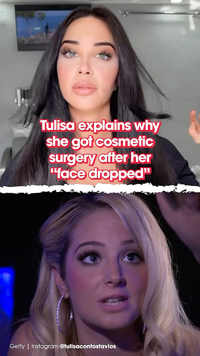 Tulisa explains why she got cosmetic surgery after her “face dropped”