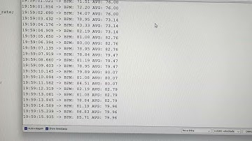 Fotopletismografia com filtro digital em um Arduino Uno.