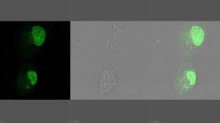 Lysosome motility in A549 cell