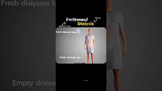 How Does Peritoneal Dialysis Work? (3D Animation)