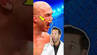 ER Doctor REACTS to UFC MMA "Split Lip"