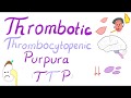 Thrombotic Thrombocytopenic Purpura (TTP)