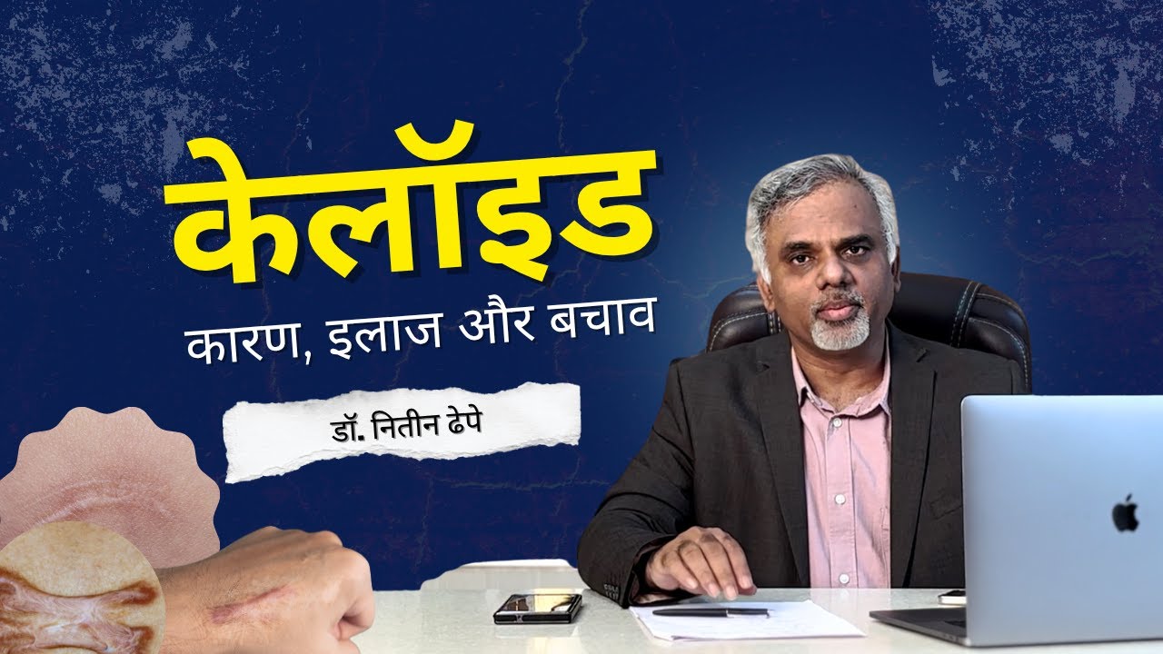 केलॉइड : कारण, इलाज और बचाव | डॉ. नितीन ढेपे से जानिए सम्पूर्ण जानकारी