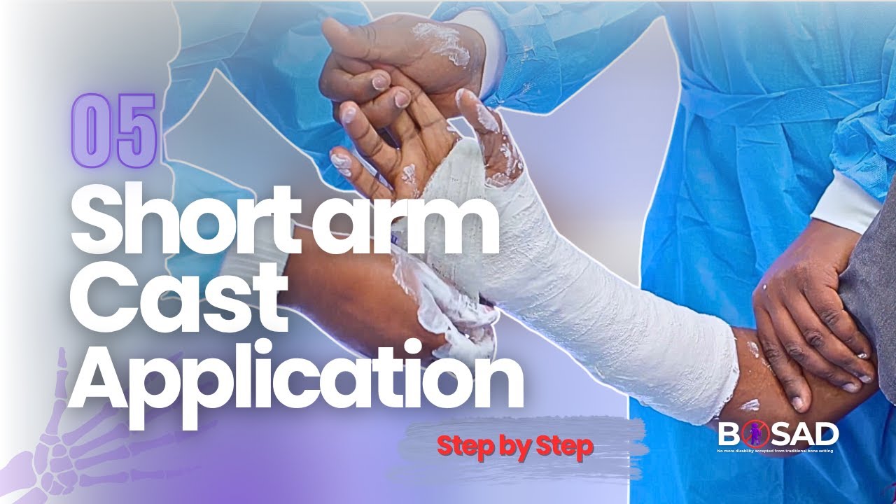 Lesson 05: Short Arm Cast Application |ከክርን በታች የሙሉ ጀሶ አሰራር| Step-by-Step Guide with Dr Zinaye Wude