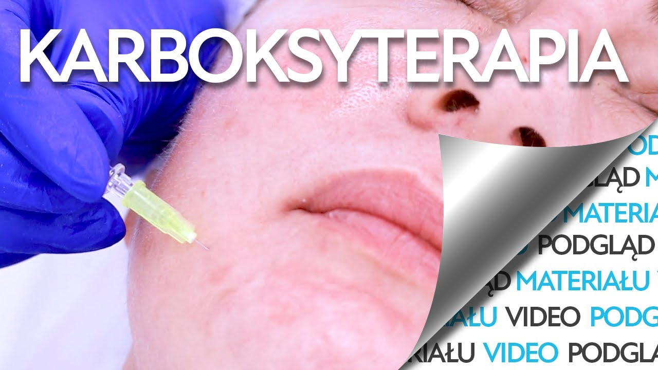 Sposób na cienie pod oczami, cellulit, zmarszczki, czyli KARBOKSYTERAPIA