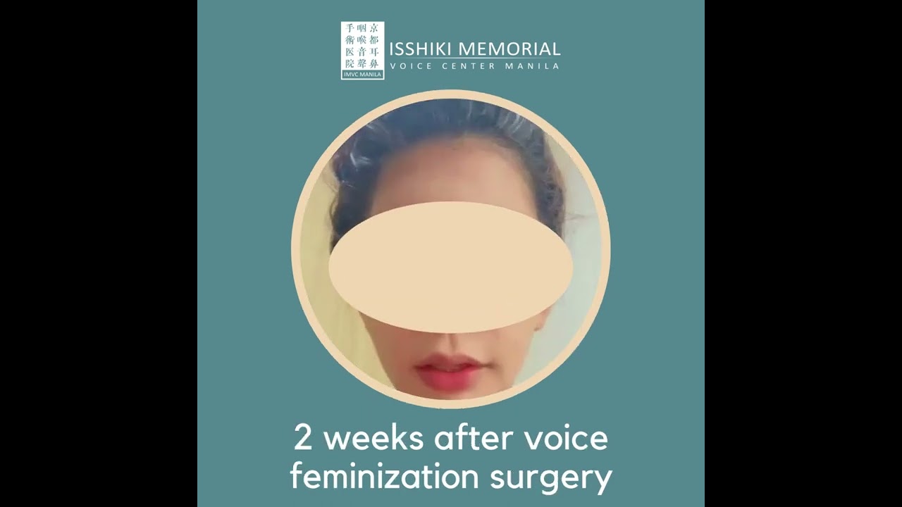 Before and After - Voice Feminization Surgery in the Philippines