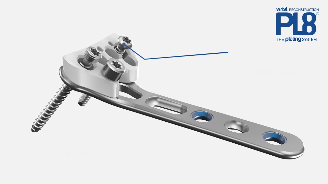 PL8 volar distal radius plate   video ENG