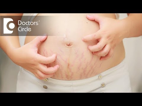 How to manage chronic itching & rashes in young women started during pregnancy? - Dr. Nischal K