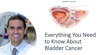 Bladder Cancer Treatment Options - Everything You Need to Know Explained by Dr. Ahdoot