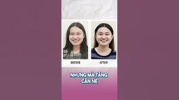 Niềng răng bị hóp má – Phải làm thế nào? | #shorts