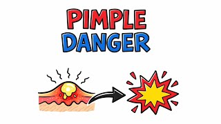 Celebrity Why You Should Never Pop a Pimple Net Worth