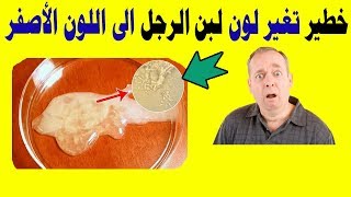 اسباب تغير لون السائل المنوى الى الاصفر والعلاج