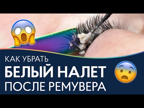 Как убрать белый налет от ремувера после снятия наращенных ресниц?