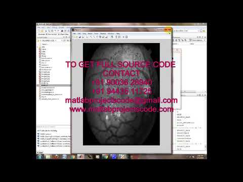 Matlab code for Segmentation of blood vessels & optic disc