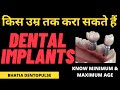 किस उम्र तक करा सकते हैं डेंटल इम्प्लांट्स-Minimum/Maximum age for dental implants Dr.Praveen Bhatia