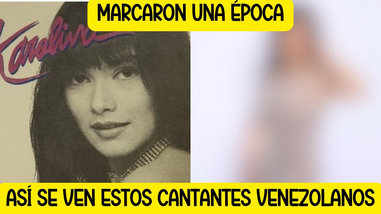 61 венесуэльских кумиров: до и после | Вы будете удивлены