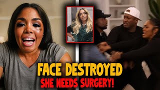 Rasheeda’s FACE DESTROYED — Plastic Surgery Needed After BRUTAL Fight! Wealth