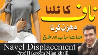 naafناف  talne ka ilaj treatment of navel displacement