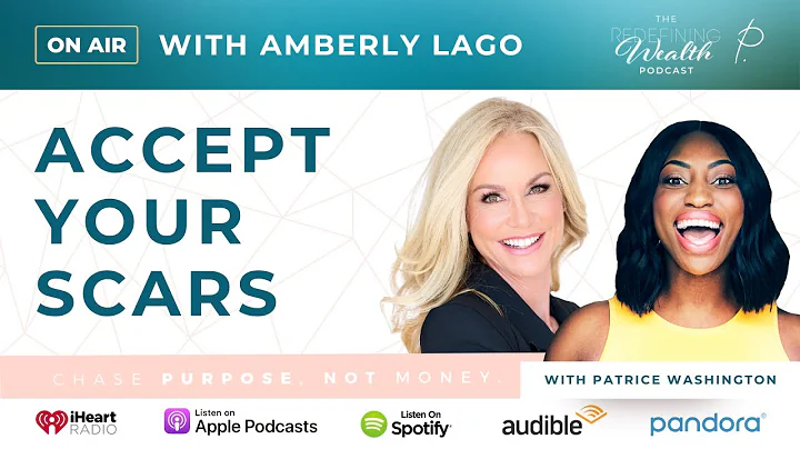 Amberly Lago: Accept Your Scars