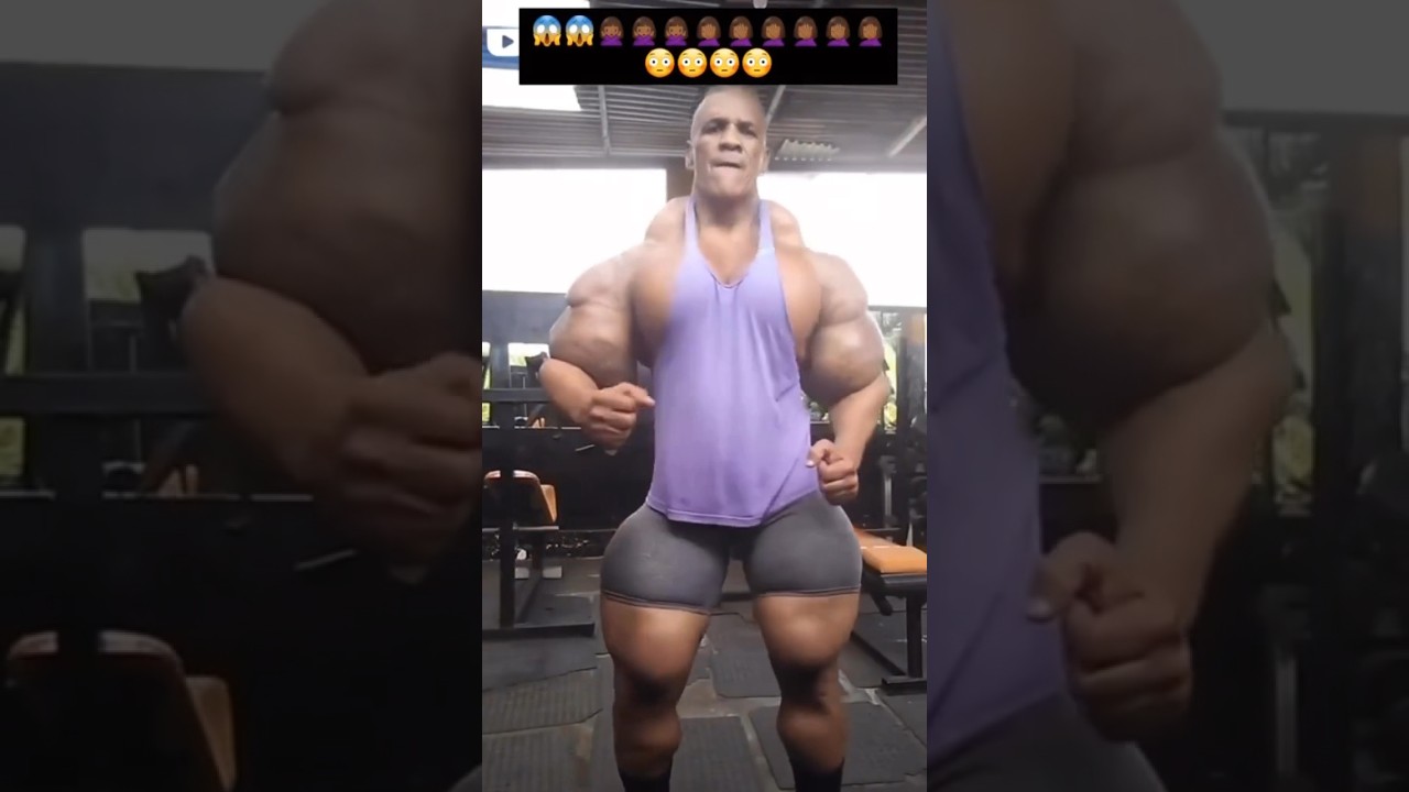 OMG, step inside the bizarre world of Synthol-overloaded bodybuilders 