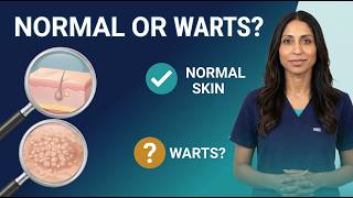 Genital Bumps: Normal Skin Changes or Warts? | Doctor Explains