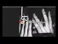 شربك سم بيدك وقالك عوافي
