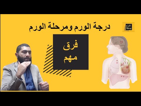 فرق بين درجة الورم و مرحلة الورم