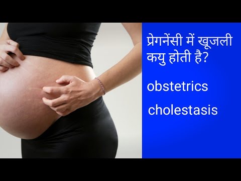 Video: Zdravlje trudnoće A-Z: Obstetrijska kolestaza