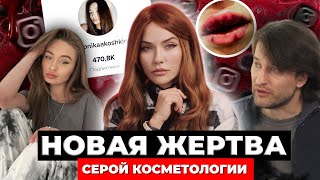 Жертва серой косметологии | ужасные Губы секты Брауде