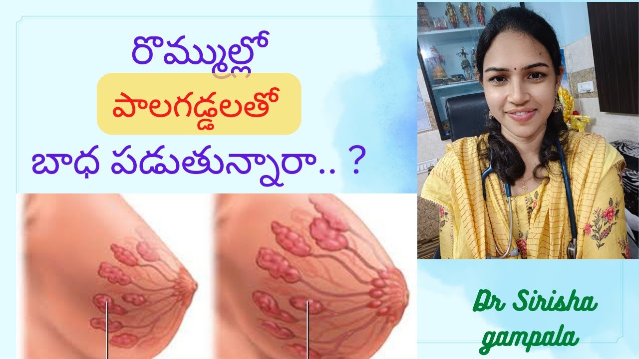 పిల్లలకి పాలు ఆపేటప్పుడు రొమ్ము గడ్డలు రాకుండా ఉండాలంటే..|| Breast engorgement || Health tips