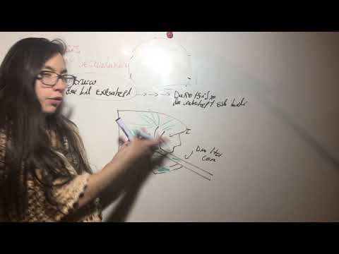 Cirrosis Biliar Secundaria.