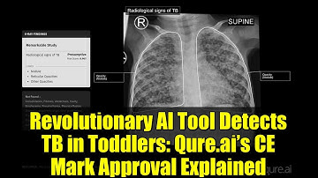 Revolutionary AI Tool Detects TB in Toddlers: Qure.ai’s CE Mark Approval Explained