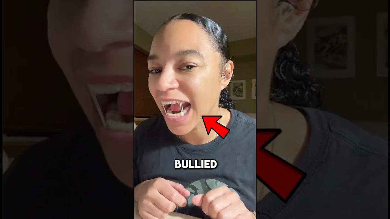 Bullied for Her Teeth… Then THIS Happened 😳🦷