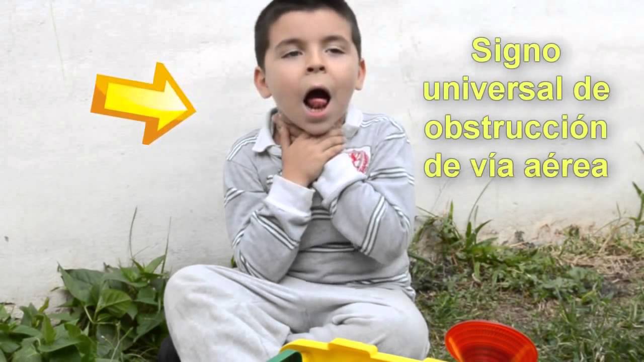 Maniobra De Desobstrucción De La Via Aerea En Niños