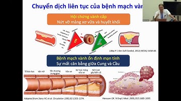Bệnh mạch vành ổn định - Đau thắt ngực [Video tim mạch 24/25]