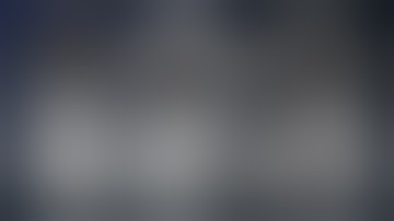 Orbitozygomatic Craniotomy for Clipping of Basilar Bifurcation Aneurysm