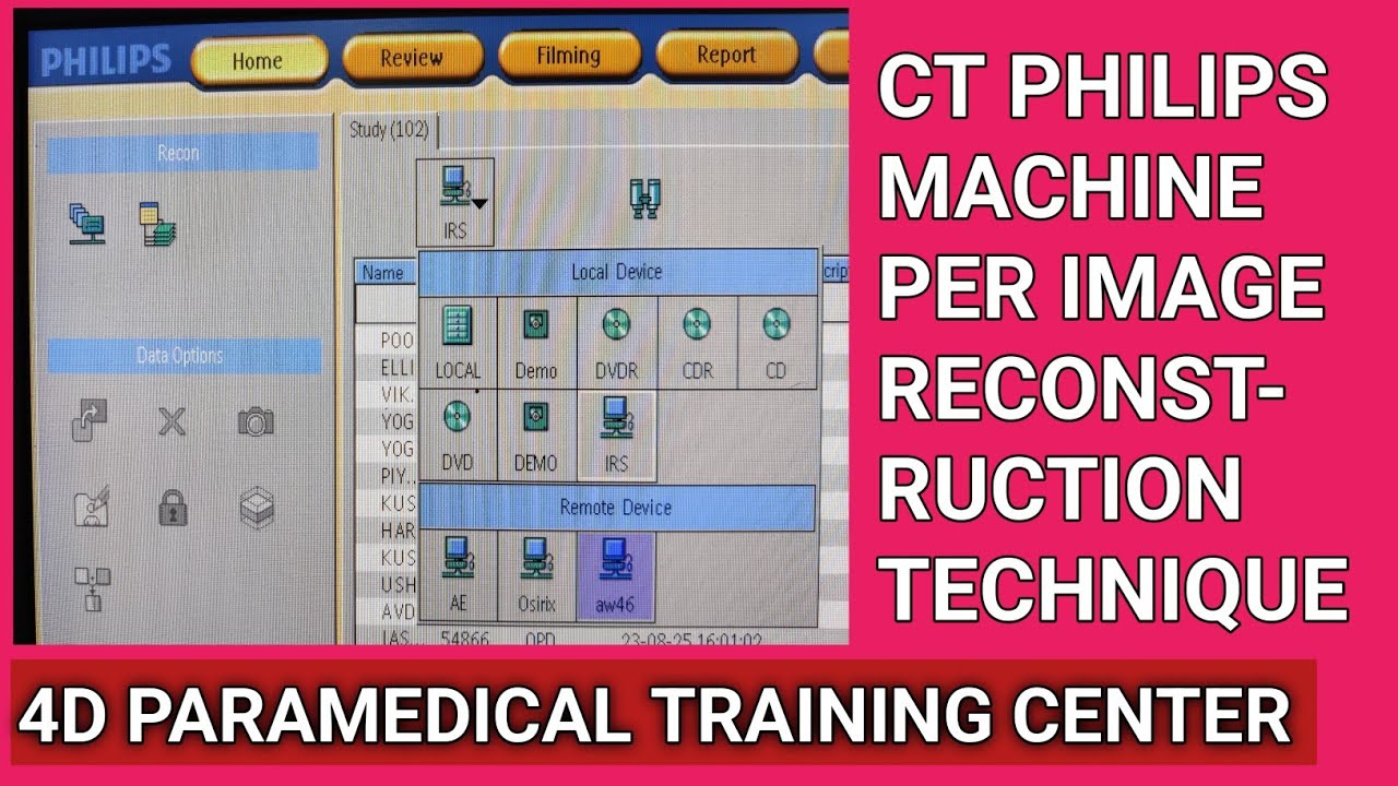 CT PHILIPS 32 SLICE MACHINE PER IMAGE RECONSTRUCTION TECHNIQUES  