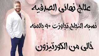 #علاج-نهائي للصدفية خالي من الكورتيزون ( تجاوزت نسبة الشفاء 90 بالمئة )