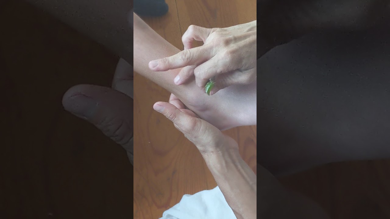 Naturally Treating a Painful Bee Sting! Part 3!! YouTube