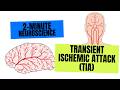 2-Minute Neuroscience: Transient Ischemic Attack (TIA)