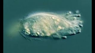 The Rarest ciliate - Legendrea Loyezae by WITH3Я 47 views 1 year ago 22 seconds