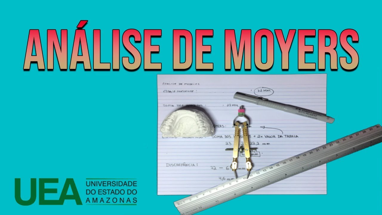 Análise da Dentição Mista pelo Método de Moyers