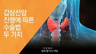 갑상선암 진행에 따른 수술법 두 가지 - (20120901_425회 방송)_갑상선암의 습격
