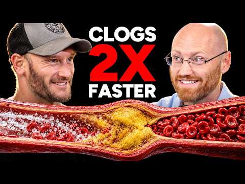 This 28,000 Person Study Found the Main Driver of Heart Disease and Plaque (Artery Doctor)