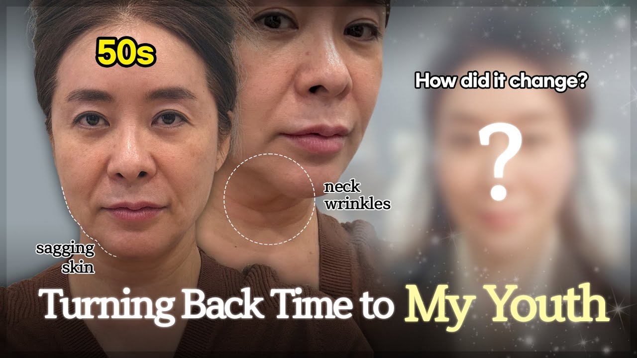 Watch Me Reverse Aging with Plastic Surgery in Korea Vlog! Part 1