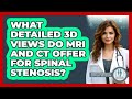 What Detailed 3D Views Do MRI And CT Offer For Spinal Stenosis? - Orthopedic Support Network